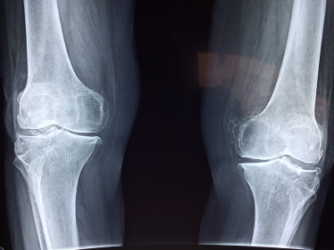 bones